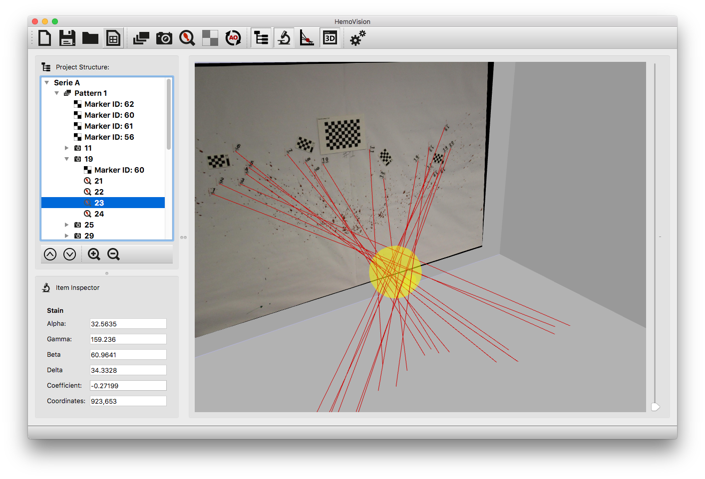 HemoVision Automated Impact Pattern Analysis